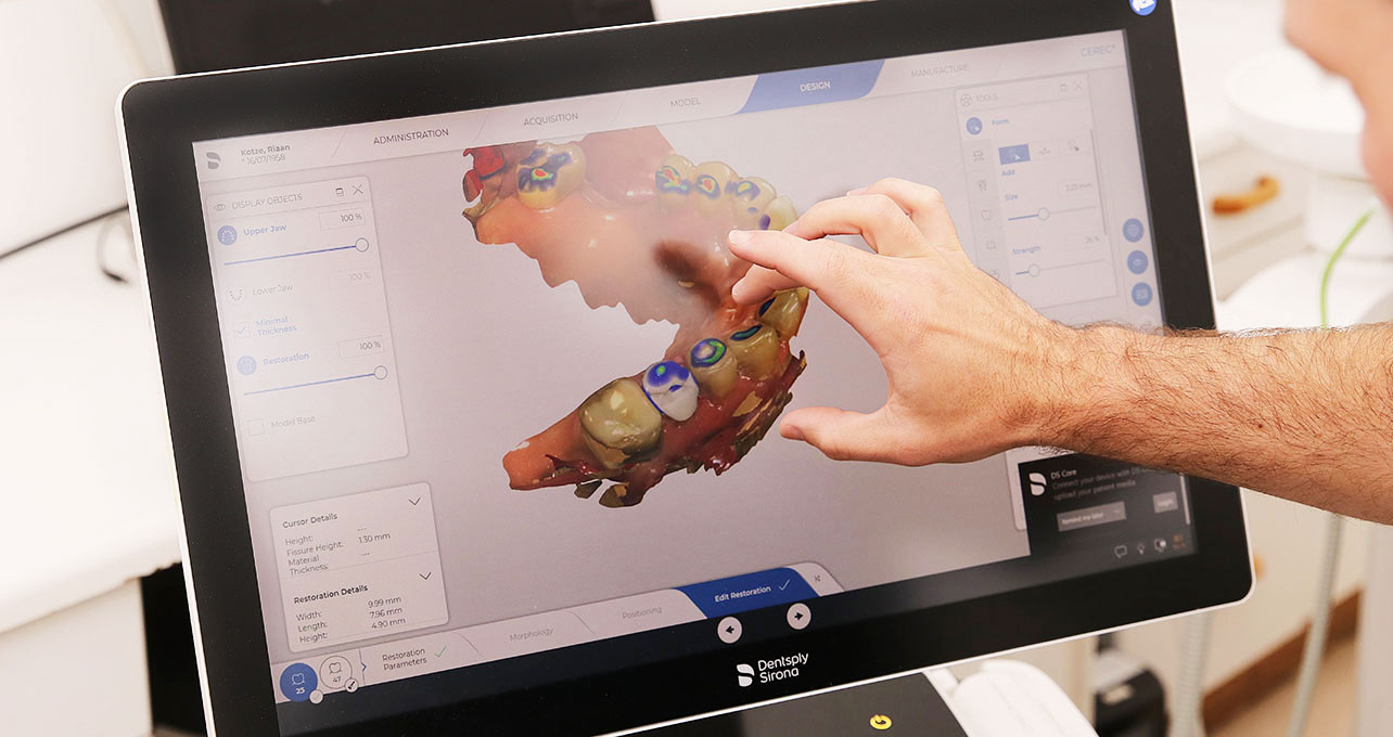 AD/CAM Crowns & Bridges